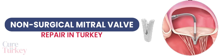 MitraClip Mitral Valve Repair